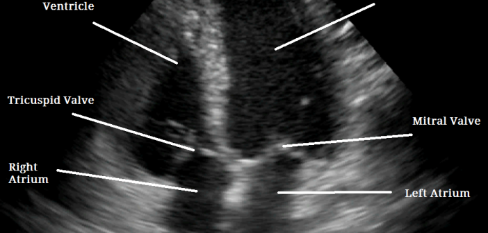 what-is-an-echocardiogram-test