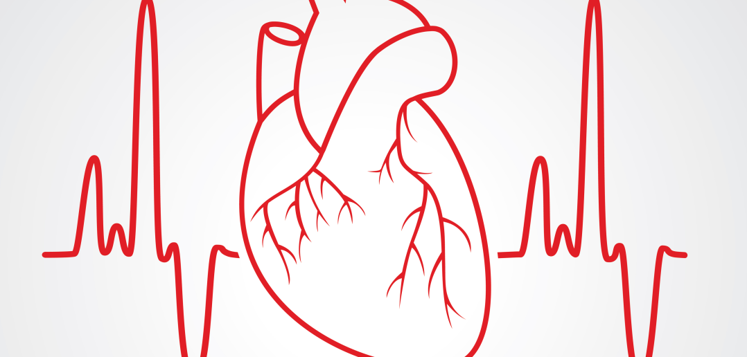 the-electrocardiogram-explained-what-is-an-ecg