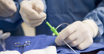 What Is A Coronary Angiogram?