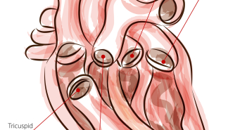 The Heart Valves