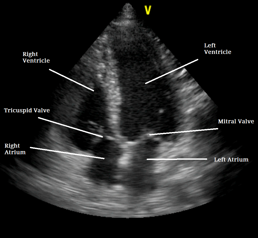 What Is A Regular Echocardiogram