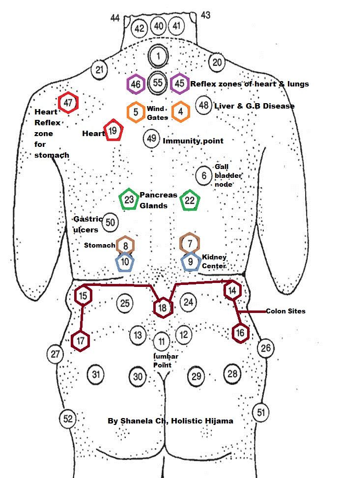 Back Cupping Points Chart