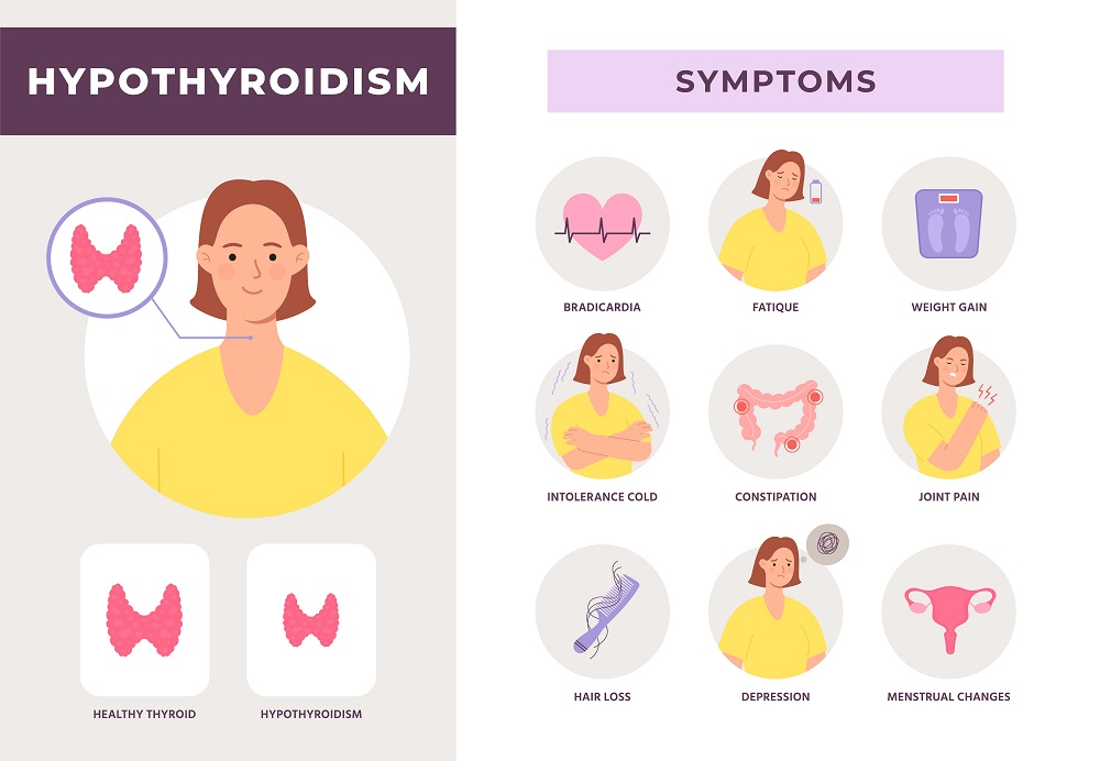 Understanding Hypothyroidism A Patient Guide Heart Sense