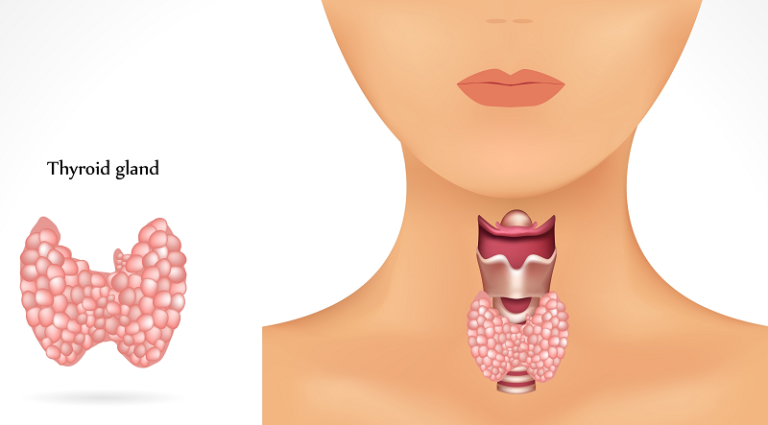 Understanding Hypothyroidism - A Patient Guide - Heart Sense